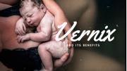 vernix